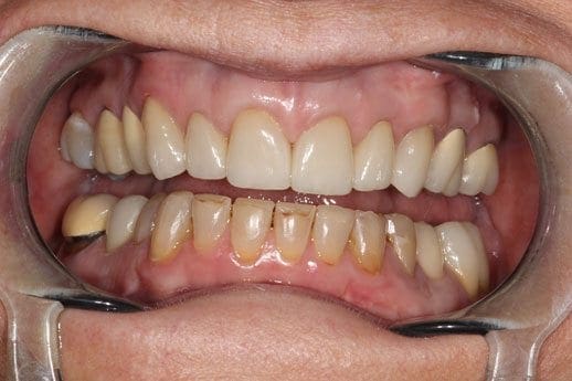 before cosmetic dentistry