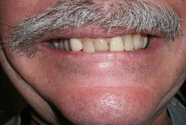 before cosmetic dentistry