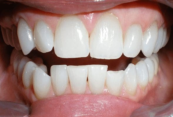 before cosmetic dentistry