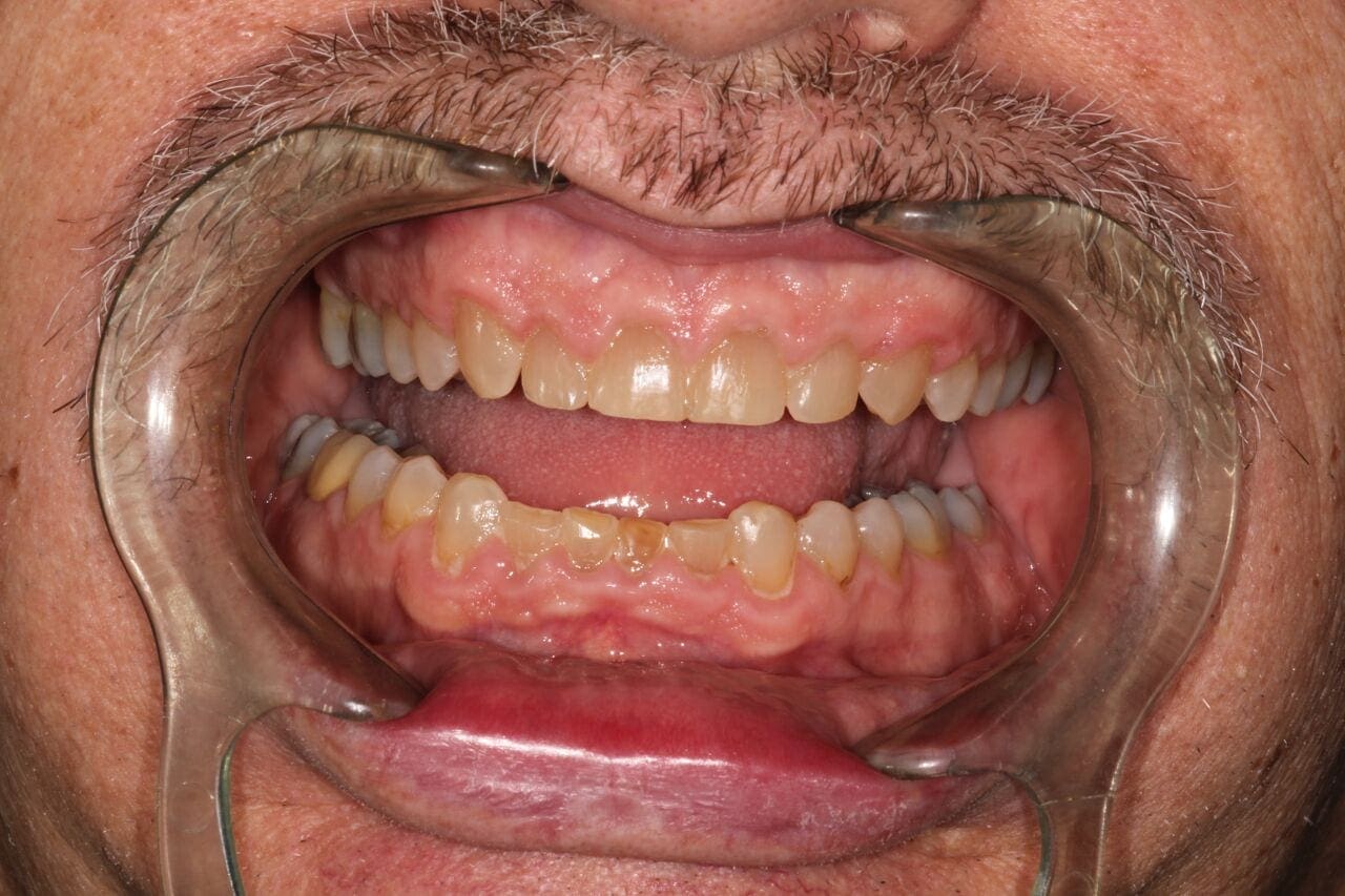 before cosmetic dentistry