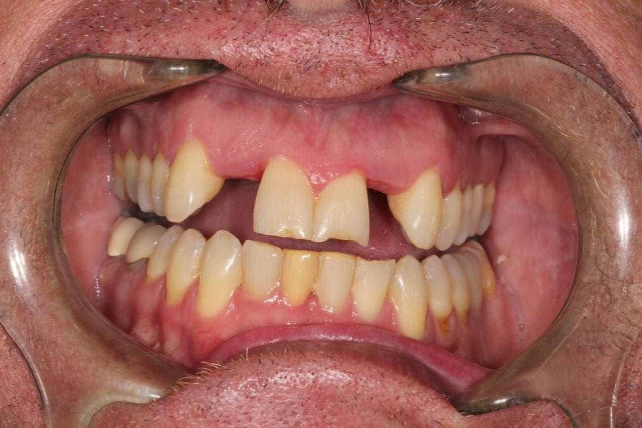 before cosmetic dentistry