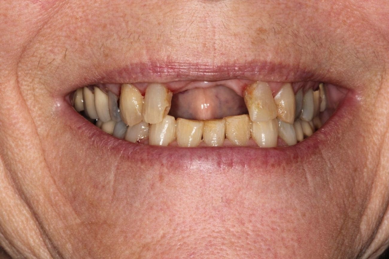 before cosmetic dentistry