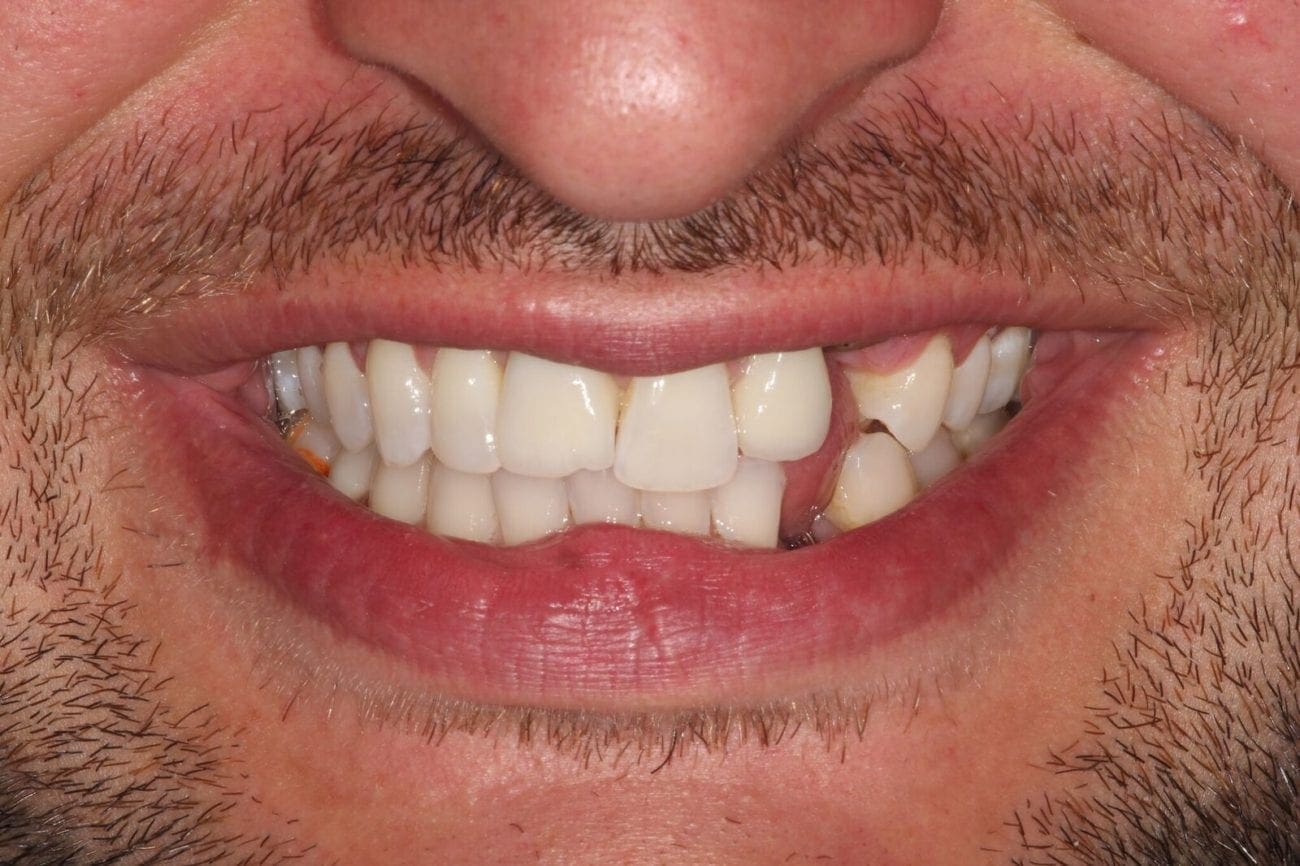 before cosmetic dentistry