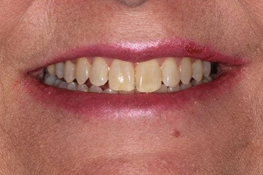 before cosmetic dentistry