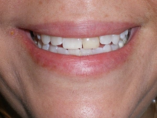 before cosmetic dentistry