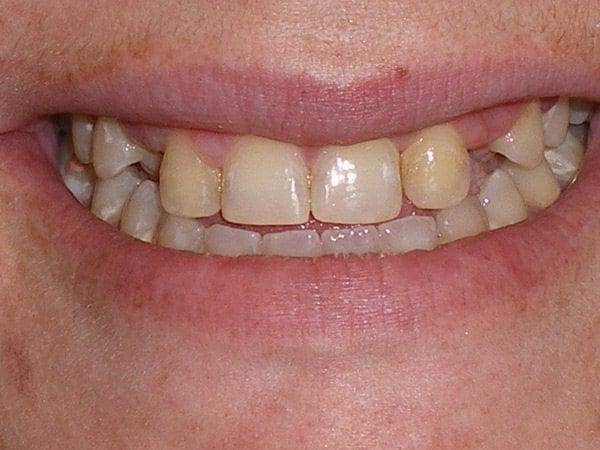 before cosmetic dentistry