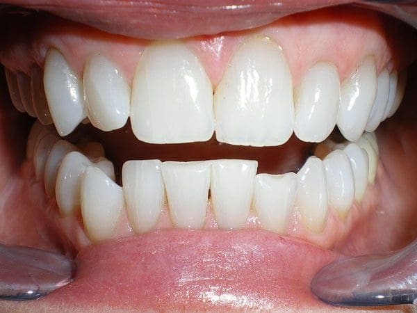 before cosmetic dentistry