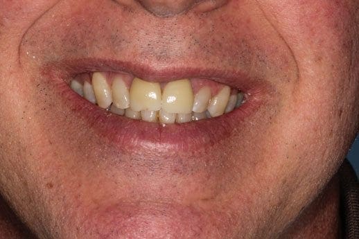 before cosmetic dentistry