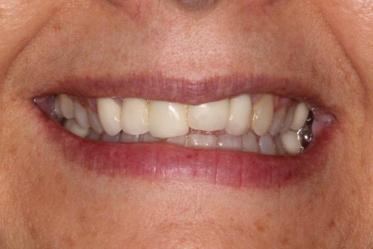 before cosmetic dentistry