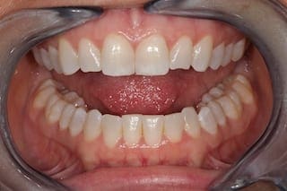 before cosmetic dentistry