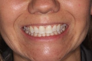 before cosmetic dentistry