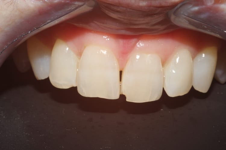 before cosmetic dentistry