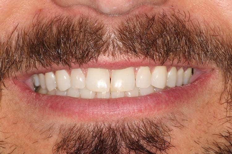 before cosmetic dentistry