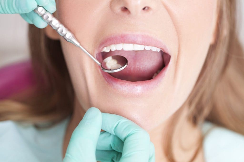 Dental Fillings in Plano, Texas