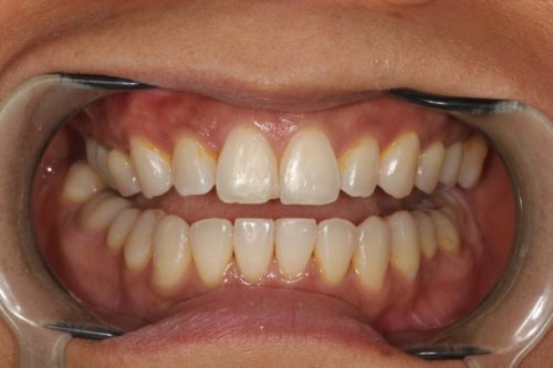 Before cosmetic dentistry