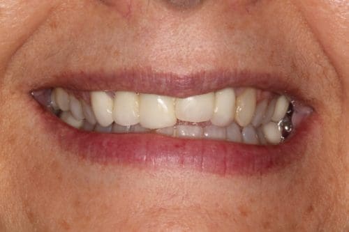 Before cosmetic dentistry