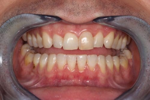 Before cosmetic dentistry