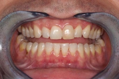 Before cosmetic dentistry