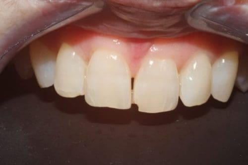 Before cosmetic dentistry