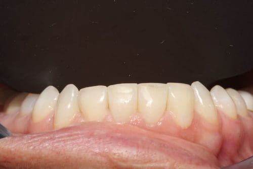 After cosmetic dentistry