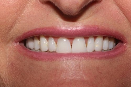 Before cosmetic dentistry