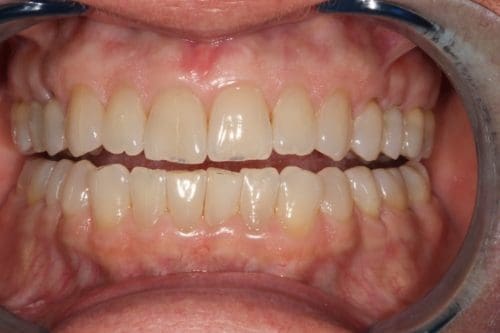 Before cosmetic dentistry