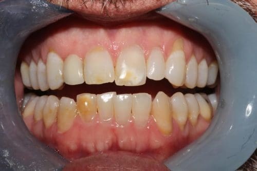 Before cosmetic dentistry