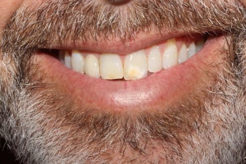 Before cosmetic dentistry