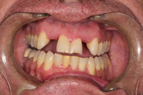 Before cosmetic dentistry