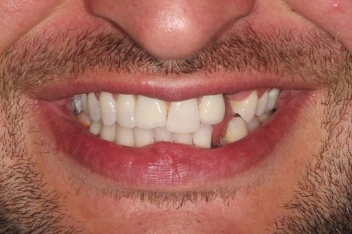 Before cosmetic dentistry