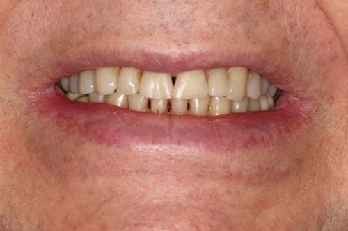 Before cosmetic dentistry