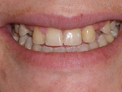 Before cosmetic dentistry