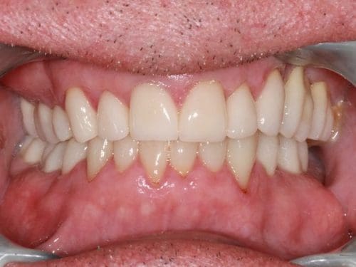 After cosmetic dentistry