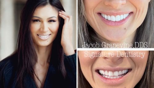 Cosmetic dentistry results in Plano, TX