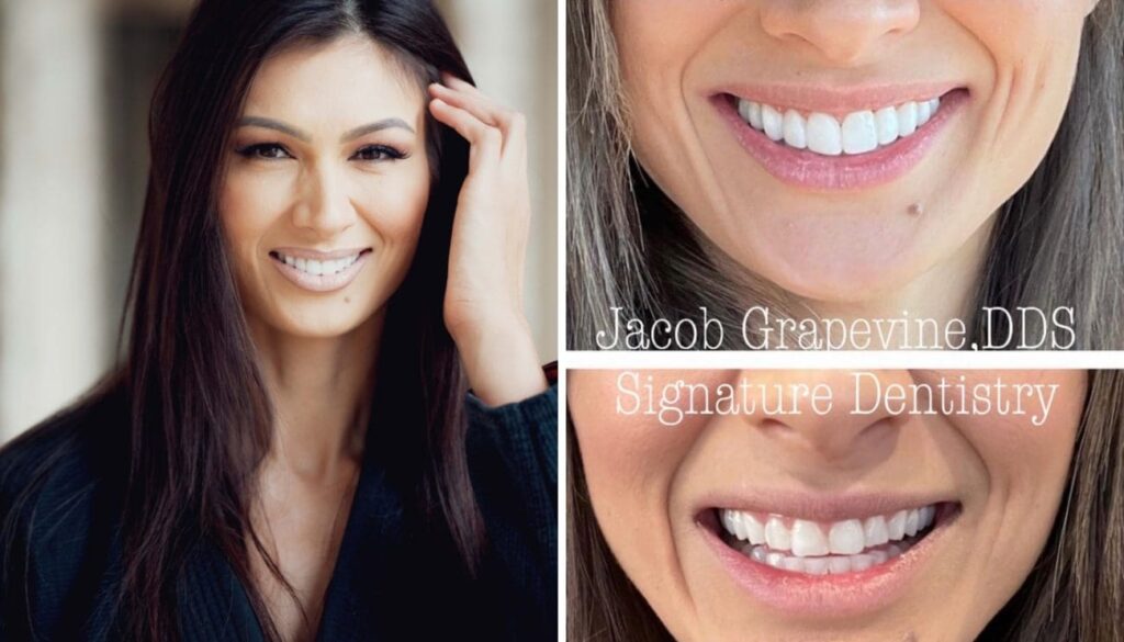 Cosmetic dentistry results in Plano, TX