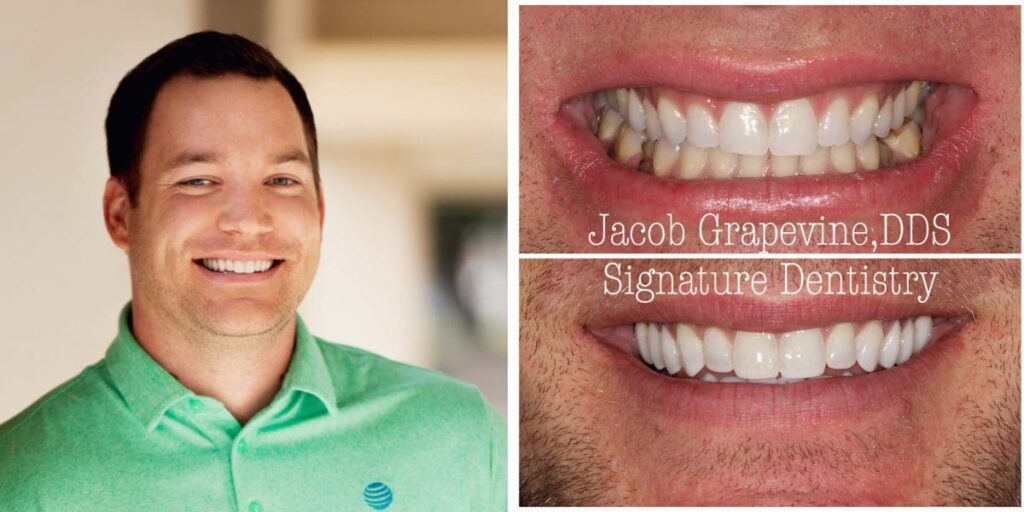 Before and after cosmetic dentistry