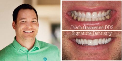 Before and after cosmetic dentistry