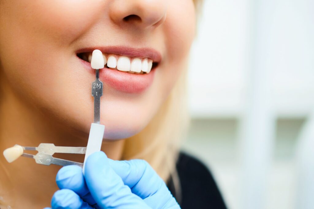 How Dentists Make Natural-Looking Veneers