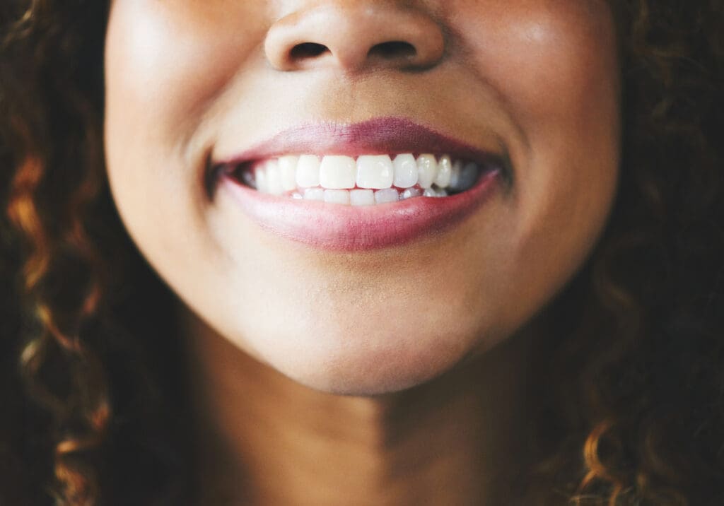 A smile makeover can transform your appearance