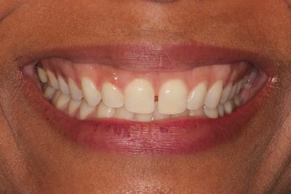 before-space-closure-2-600x400