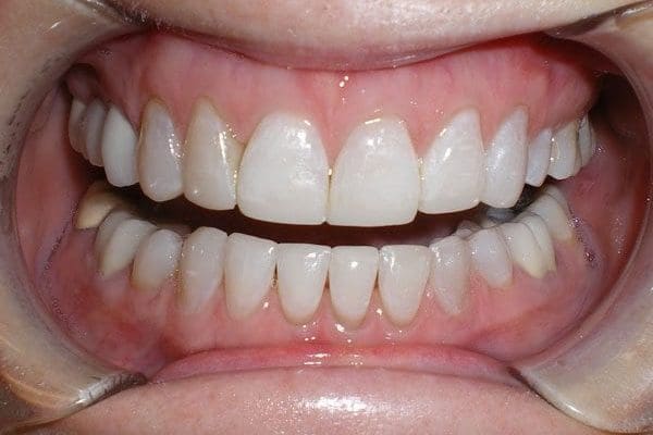 patient-e-after-600x400