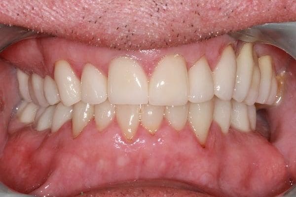 patient-g-after-600x400